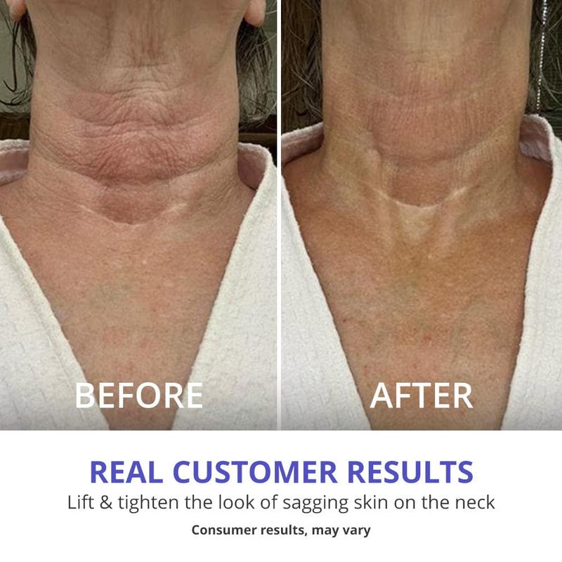 Neck cream