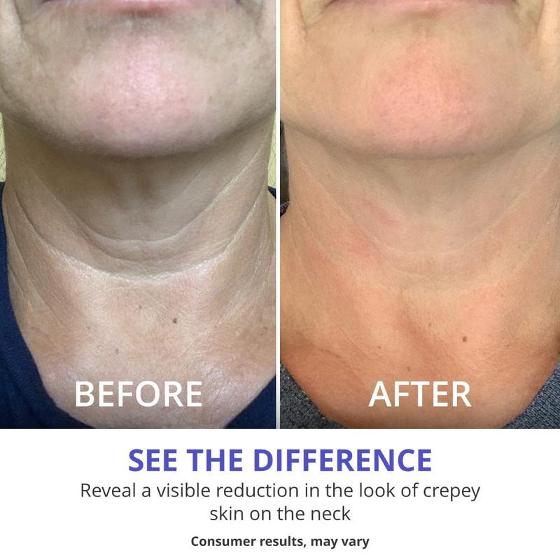 Neck cream