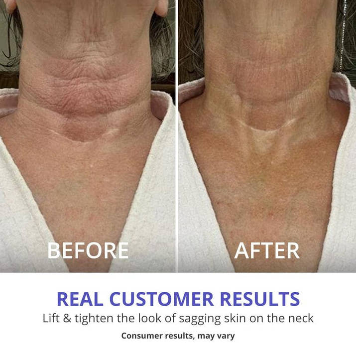 Neck cream