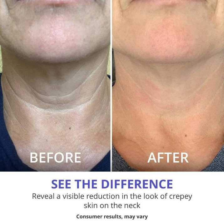 Neck cream