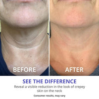 Neck cream