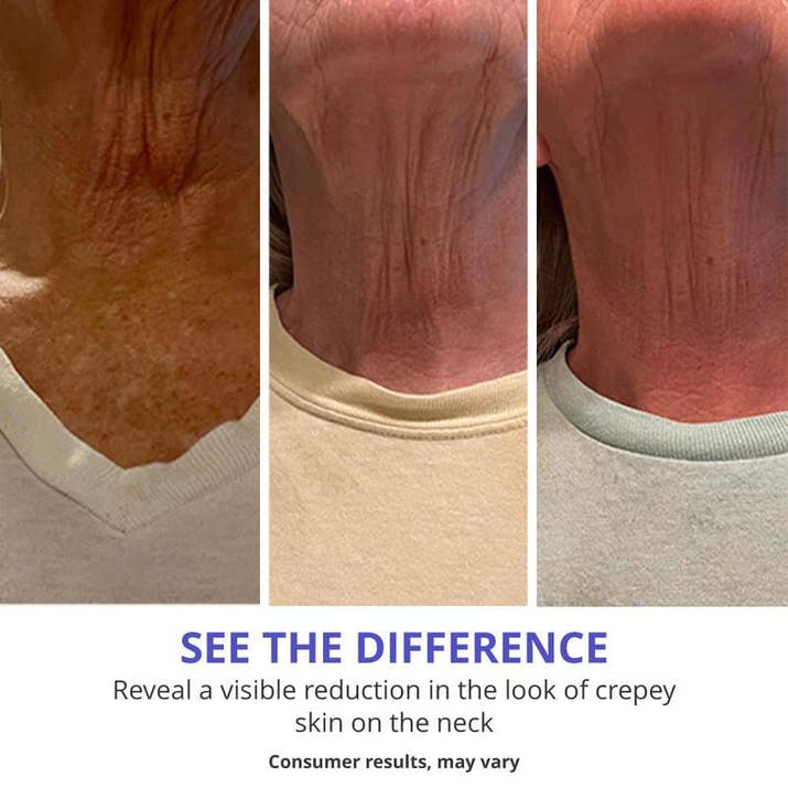Neck cream
