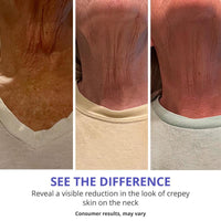 Neck cream